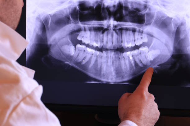 Best Broken or Chipped Tooth Repair in Greenville, VA