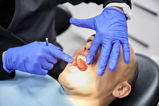 Best Emergency Wisdom Tooth Extraction in Greenville, VA