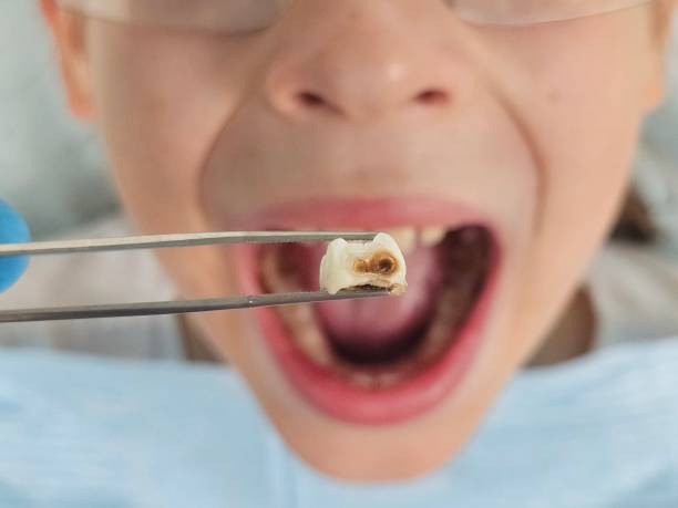 Best Walk-In Emergency Dental Services in Greenville, VA